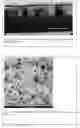 Fig. 06 - Electrically conductive underlayer to grow FePt granular media with (001) texture on glass substrates