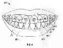 Fig. 06 - Oral illumination systems and methods