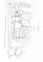 Fig. 02 - Orthodontic appliance