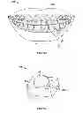 Fig. 02 - ORAL ILLUMINATION SYSTEMS AND METHODS