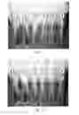 Fig. 08 - Floss device, a method of forming the floss device and a method of using the floss device
