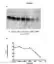 Fig. 09 - Methods of diagnosing ALS