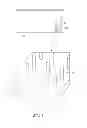 Fig. 02 - Supports and methods for promoting integration of cartilage tissue explants