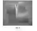 Fig. 07 - Supports and methods for promoting integration of cartilage tissue explants