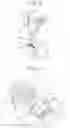 Fig. 07 - Round terminal fixation structure