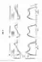 Fig. 07 - SYSTEM AND METHODS FOR MEASURING PROPULSIVE FORCE DURING AMBULATION AND PROVIDING REAL-TIME FEEDBACK