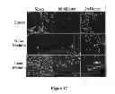 Fig. 22 - Screening methods of BMP/GDF signaling modulators using DRG11-responsive (DRAGON) proteins