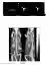 Fig. 02 - Multimodal contrast and radiopharmaceutical agent for an imaging and a targeted therapy guided by imaging