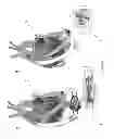 Fig. 09 - System and method for heart pump interrogation and inspection