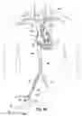 Fig. 03 - Transseptal cannula, tip, delivery system, and method