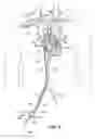 Fig. 04 - Transseptal cannula, tip, delivery system, and method