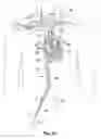 Fig. 05 - Transseptal cannula, tip, delivery system, and method