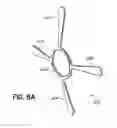Fig. 18 - Transseptal cannula, tip, delivery system, and method