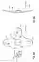 Fig. 19 - Transseptal cannula, tip, delivery system, and method