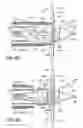 Fig. 26 - Transseptal cannula, tip, delivery system, and method