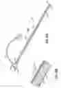 Fig. 34 - Transseptal cannula, tip, delivery system, and method