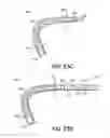 Fig. 41 - Transseptal cannula, tip, delivery system, and method