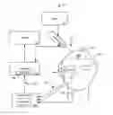 Fig. 01 - Systems and methods for delivering bone conduction stimuli to and for measuring gravitation receptor functions of the inner ear