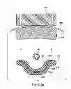 Fig. 100 - Systems, devices and methods for minimally invasive pelvic surgery