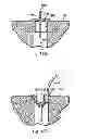 Fig. 110 - Systems, devices and methods for minimally invasive pelvic surgery
