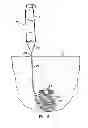 Fig. 12 - Systems, devices and methods for minimally invasive pelvic surgery