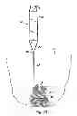 Fig. 13 - Systems, devices and methods for minimally invasive pelvic surgery