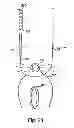 Fig. 20 - Systems, devices and methods for minimally invasive pelvic surgery