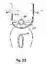 Fig. 22 - Systems, devices and methods for minimally invasive pelvic surgery