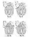 Fig. 27 - Systems, devices and methods for minimally invasive pelvic surgery