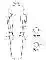 Fig. 30 - Systems, devices and methods for minimally invasive pelvic surgery