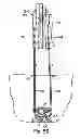 Fig. 40 - Systems, devices and methods for minimally invasive pelvic surgery