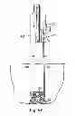Fig. 41 - Systems, devices and methods for minimally invasive pelvic surgery