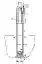 Fig. 43 - Systems, devices and methods for minimally invasive pelvic surgery