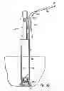 Fig. 44 - Systems, devices and methods for minimally invasive pelvic surgery