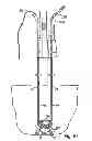 Fig. 45 - Systems, devices and methods for minimally invasive pelvic surgery