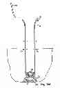 Fig. 48 - Systems, devices and methods for minimally invasive pelvic surgery
