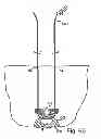 Fig. 49 - Systems, devices and methods for minimally invasive pelvic surgery