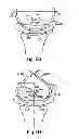 Fig. 64 - Systems, devices and methods for minimally invasive pelvic surgery