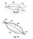 Fig. 65 - Systems, devices and methods for minimally invasive pelvic surgery