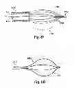 Fig. 67 - Systems, devices and methods for minimally invasive pelvic surgery