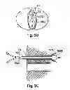 Fig. 68 - Systems, devices and methods for minimally invasive pelvic surgery