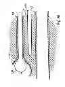 Fig. 69 - Systems, devices and methods for minimally invasive pelvic surgery
