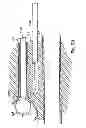 Fig. 71 - Systems, devices and methods for minimally invasive pelvic surgery