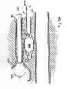 Fig. 72 - Systems, devices and methods for minimally invasive pelvic surgery