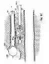Fig. 74 - Systems, devices and methods for minimally invasive pelvic surgery