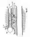 Fig. 75 - Systems, devices and methods for minimally invasive pelvic surgery
