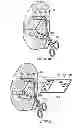 Fig. 80 - Systems, devices and methods for minimally invasive pelvic surgery