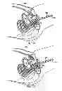 Fig. 82 - Systems, devices and methods for minimally invasive pelvic surgery