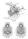 Fig. 83 - Systems, devices and methods for minimally invasive pelvic surgery