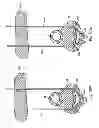 Fig. 86 - Systems, devices and methods for minimally invasive pelvic surgery